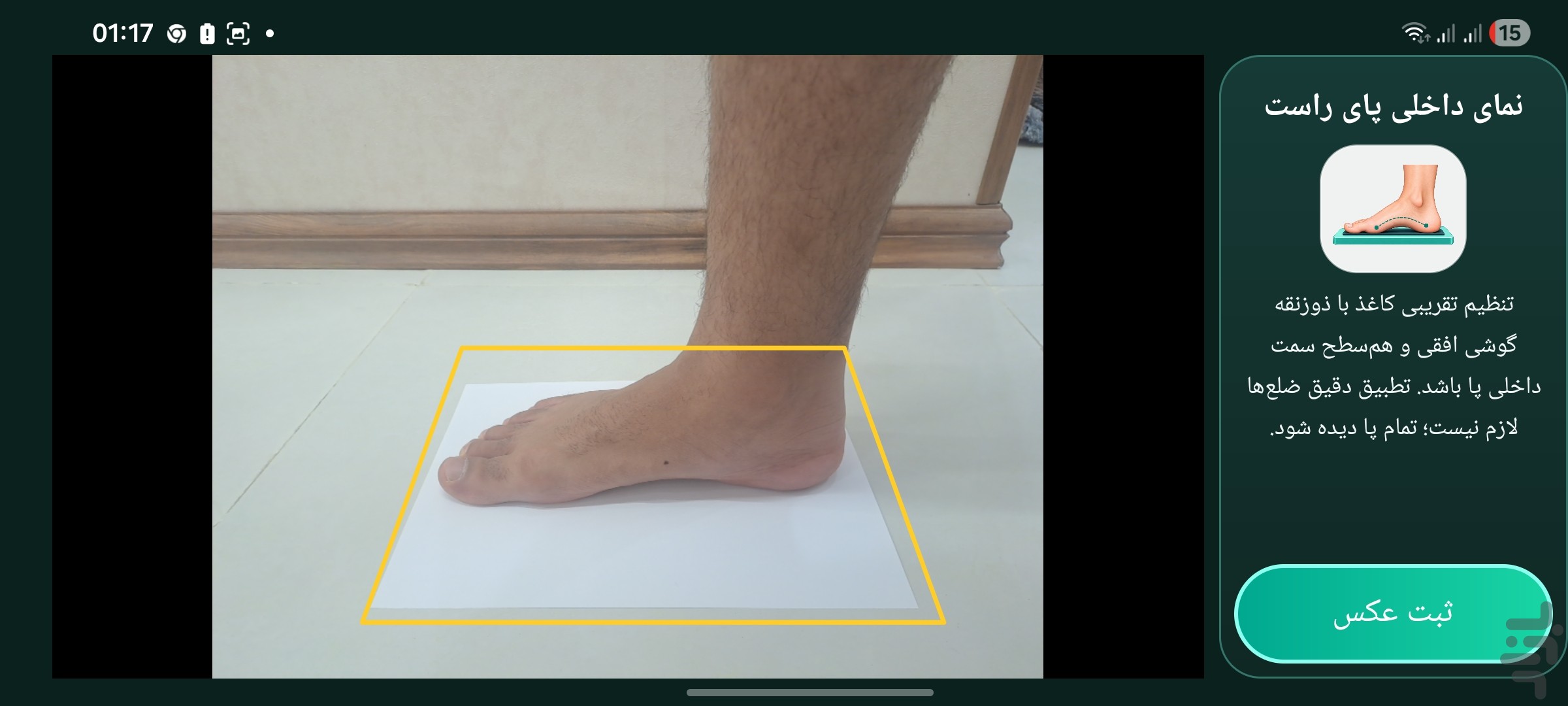 اسکن پای عظیم طب — تصویر 4